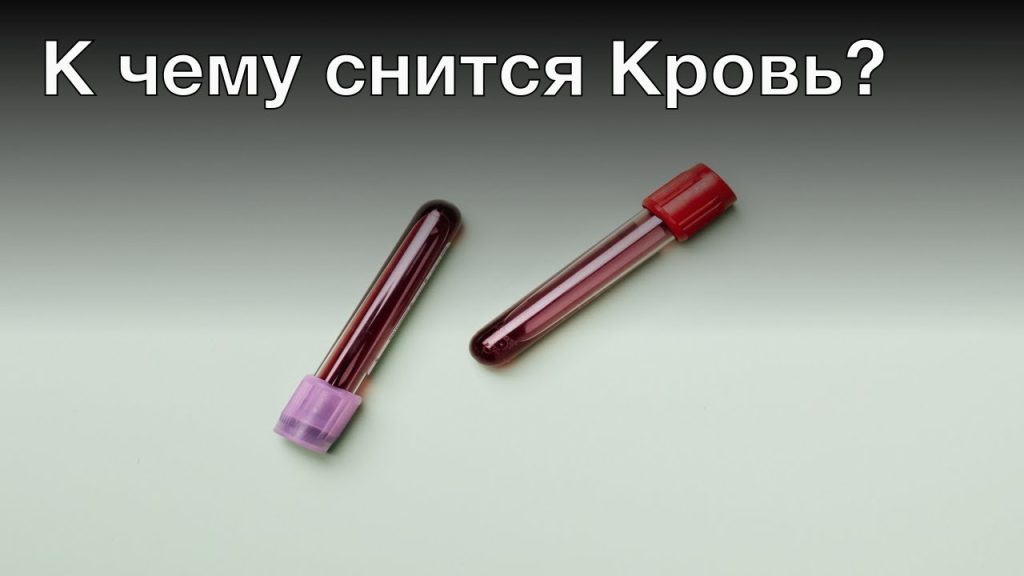 К Чему Снится Кровь: Толкования и Значения в Сновидениях